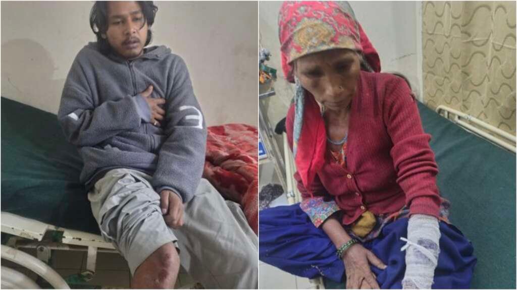 चमोली के जोशीमठ में भालू के हमले में घायल मां-बेटे की तस्वीर
